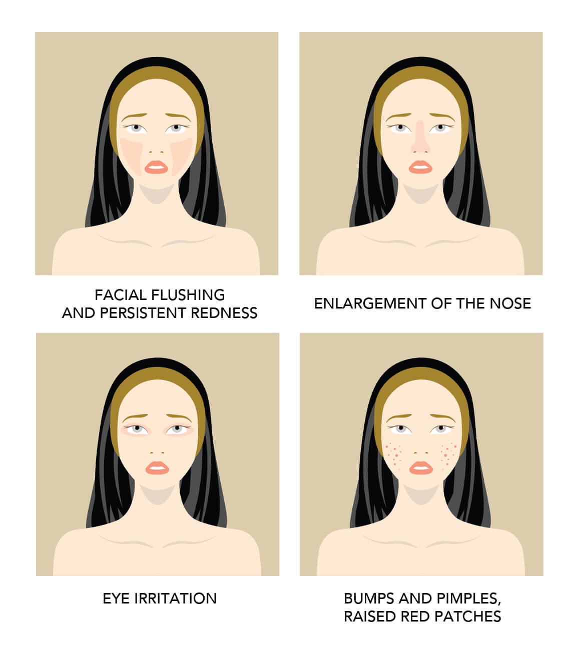 rosacea in graphics