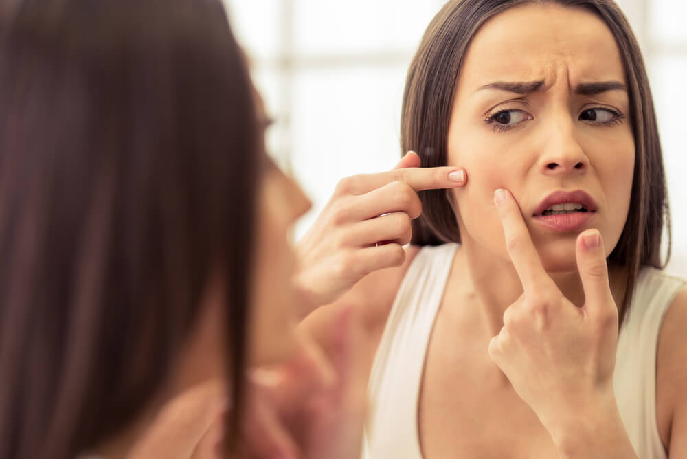 woman struggling with acne