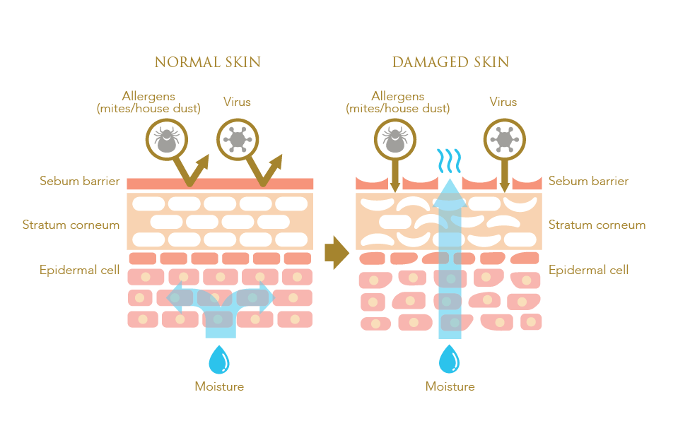 normal vs damaged skin
