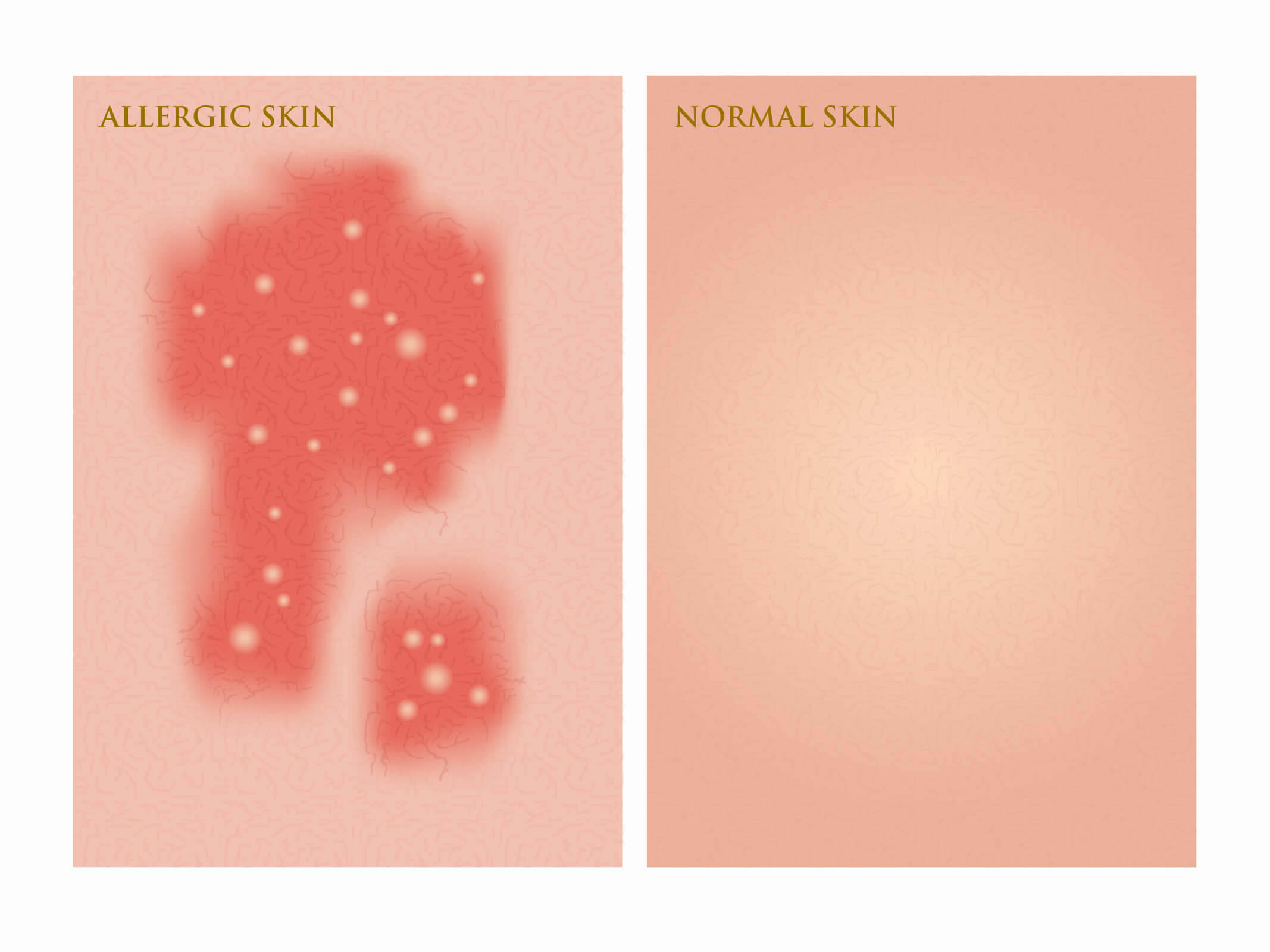 allergic vs normal skin