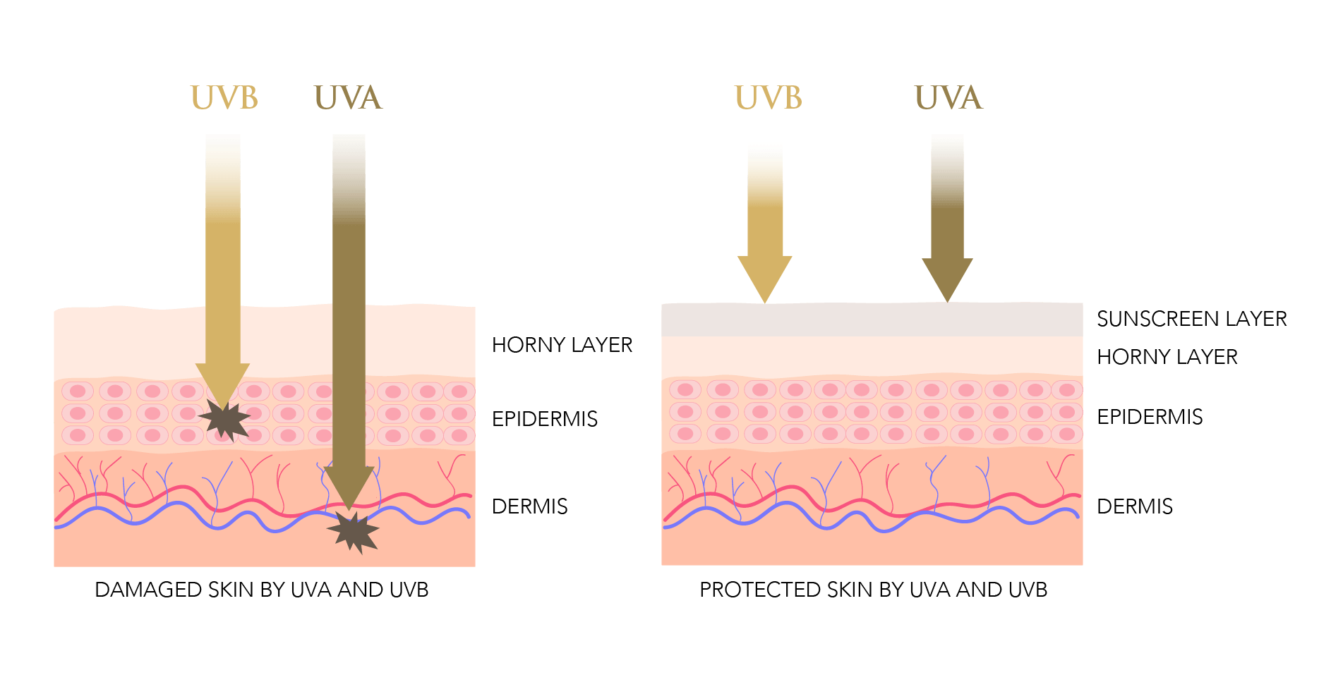 protected vs unprotected skin by sunscreen
