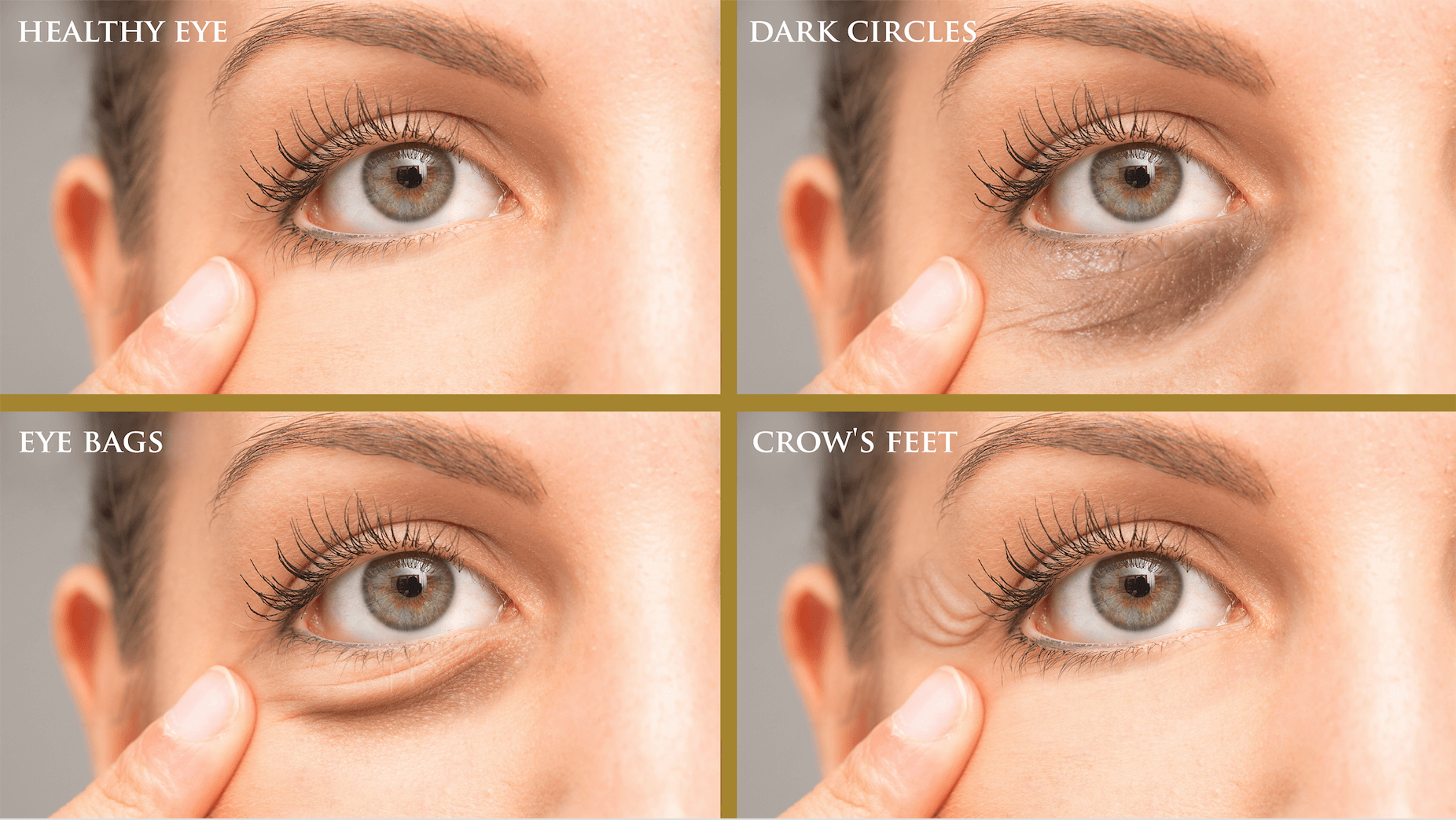 different skin concerns around the eyes