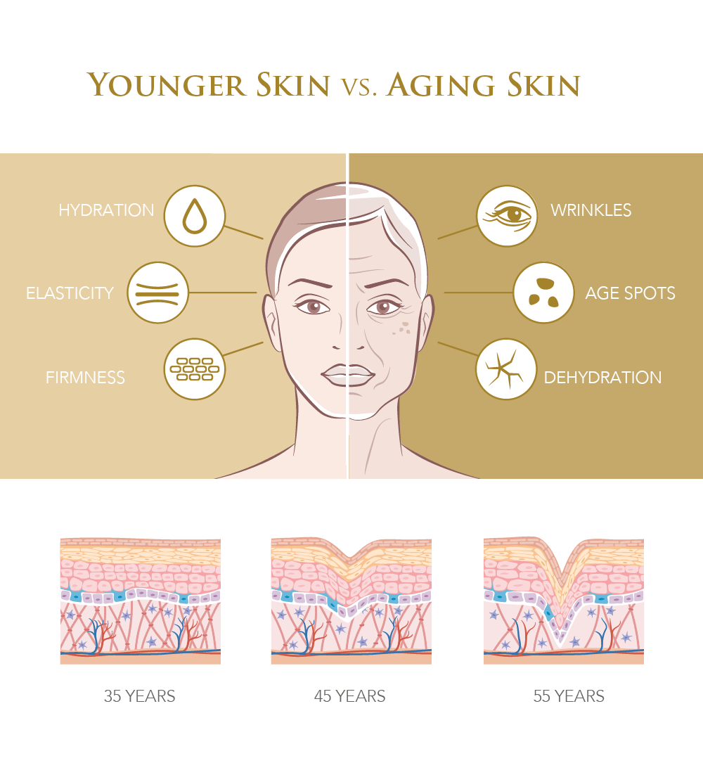 Infographic on younger vs aging skin