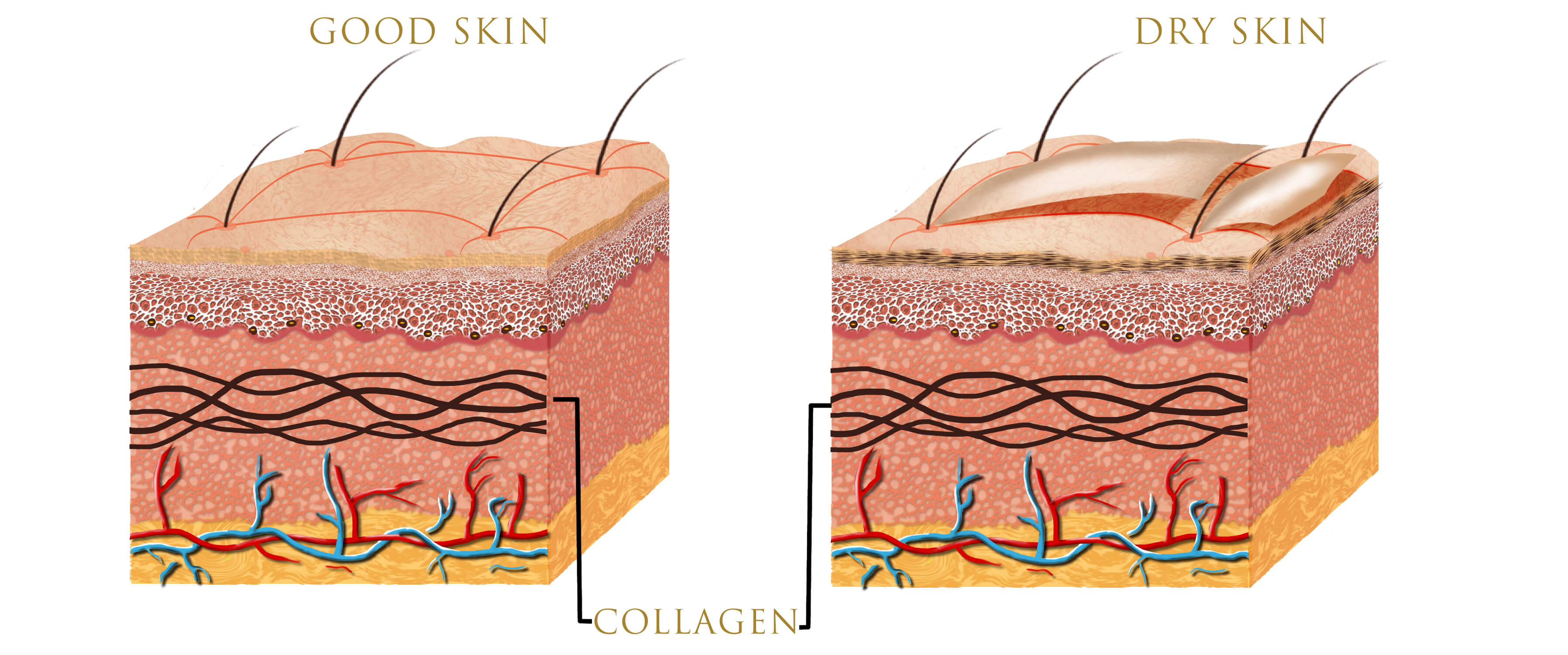 Infographic on layers of skin and the role of collagen