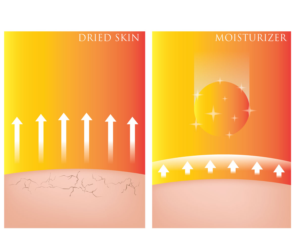 Illustration of dry skin versus moisturized skin